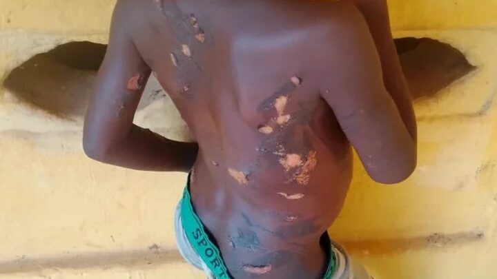 Police arrest mother in Anambra for burning daughter with hot — image de l’article